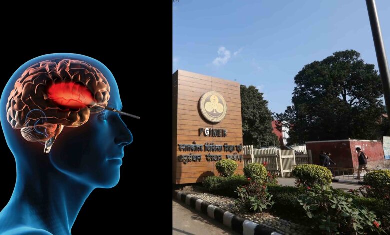 PGI Chandigarh